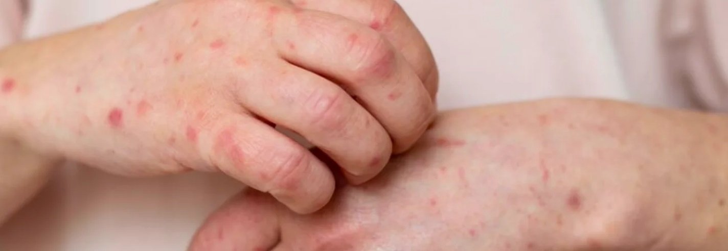 ����: inaktau.kz