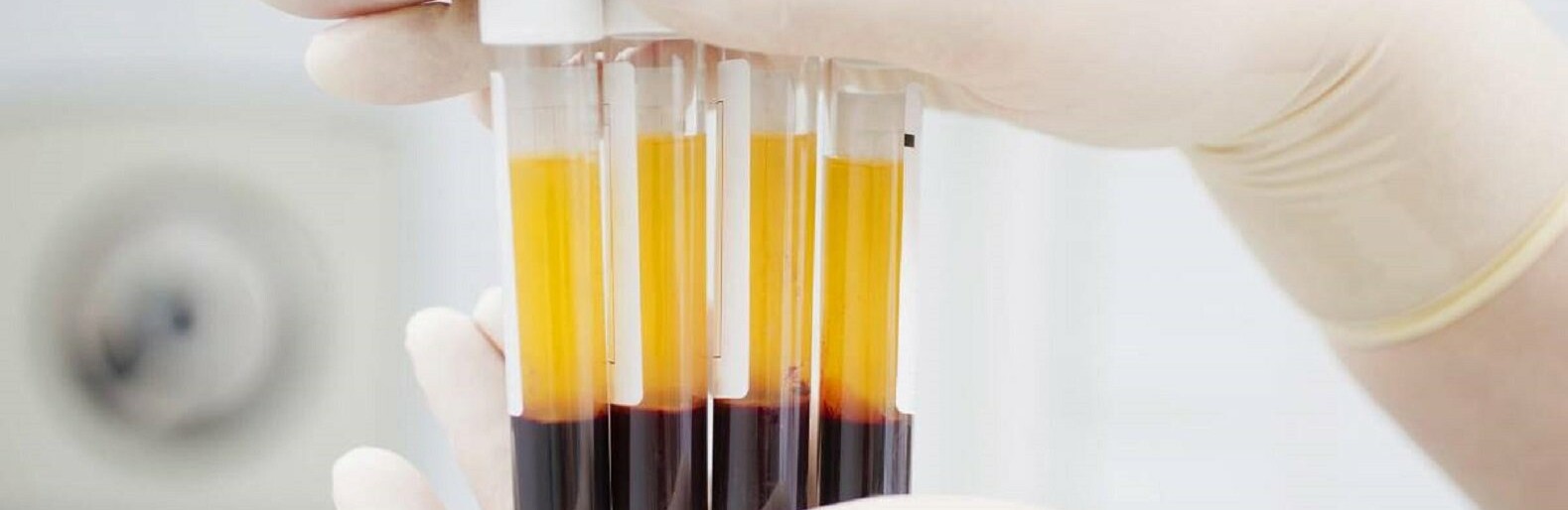 ����: inaktau.kz