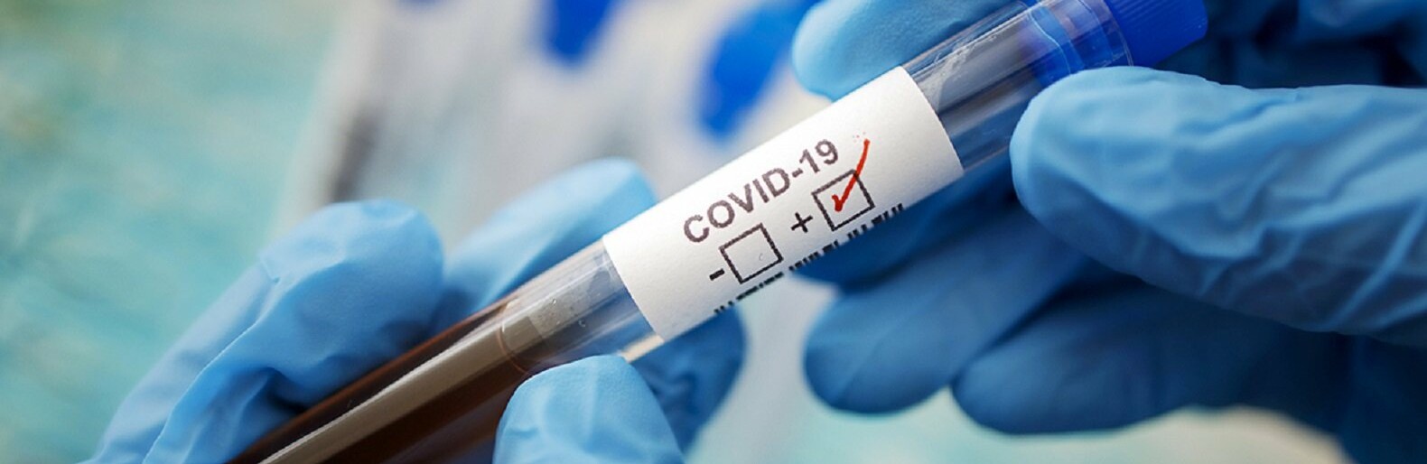  ����� ������ ����� ��������� covid-19 