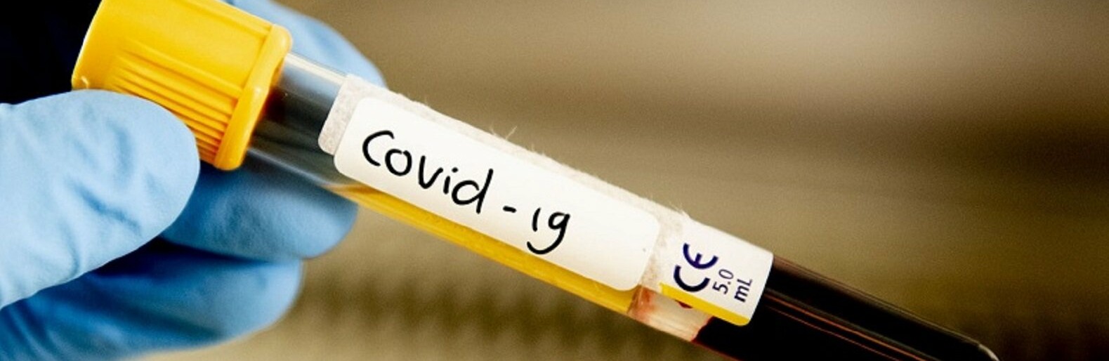  ������� ��������� covid-19 ���������� ��������� ��������� 
